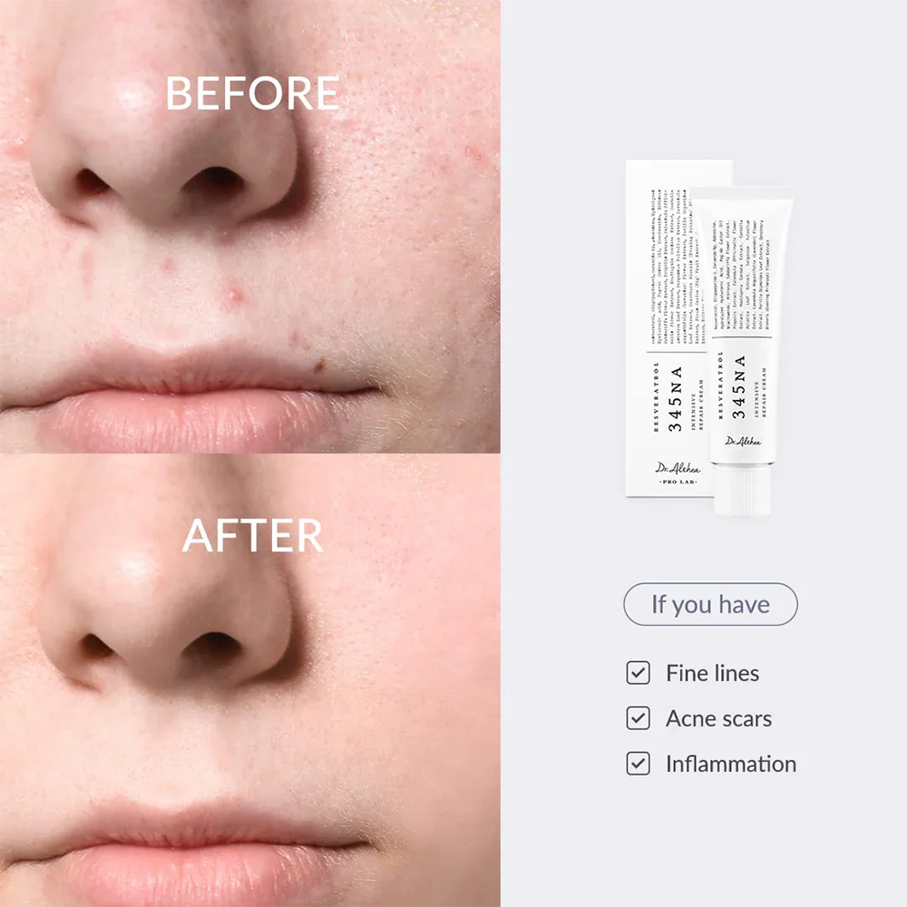کرم ترمیم کننده 345 دکتر التیا 5 کرم ترمیم کننده 345 دکتر التیا Dr.Althea 345 Relief Cream