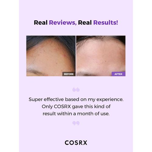 تونر لایه بردار درمانی و آبرسان AHA و BHA کوزارکس COSRX AHA_BHA Clarifying Treatment Toner