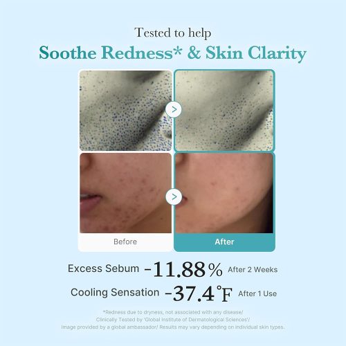 تونر آزلائیک اسید و نیاسینامید مدی کیوب ضدقرمزی و روشن کننده پوست Medicube Azelaic Acid Niacinamide Clear Toner