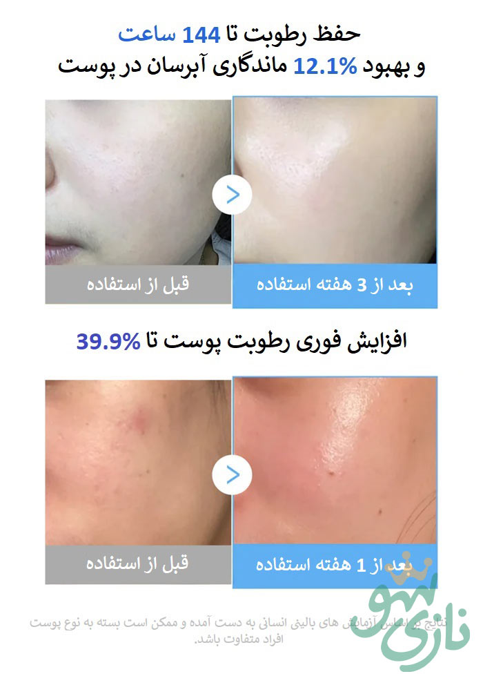 سرم هیالورونیک اسید و مولتی پپتاید مدی کیوب آبرسان و جوانساز 21 سرم هیالورونیک اسید و مولتی پپتاید مدی کیوب آبرسان و جوانساز Medicube Hyaluronic Multi Peptide Serum