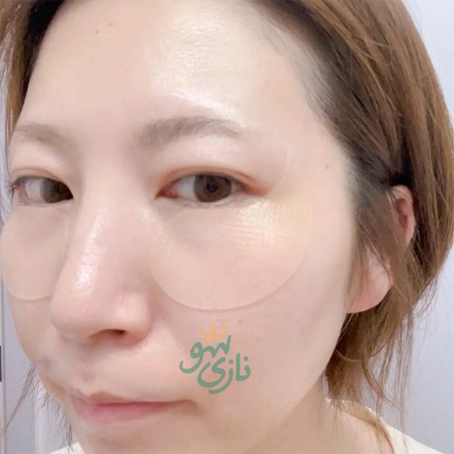 پچ دور چشم کلسیم سمنریت دکتر ملاکسین ضدچروک و روشن کننده Dr.Melaxin Cemenrete Calcium Volume Eye Patch