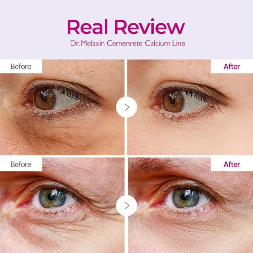 پچ دور چشم کلسیم سمنریت دکتر ملاکسین ضدچروک و روشن کننده Dr.Melaxin Cemenrete Calcium Volume Eye Patch