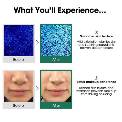 تونر 30 روزه میراکل سام بای می ضد جوش و لایه بردار Some By Mi AHA BHA PHA 30 Days Miracle Toner
