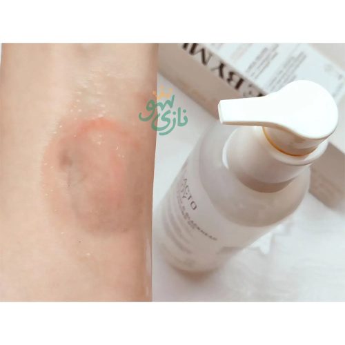 شوینده روغنی لاکتو سویا سام بای می ضد جوش سرسیاه و کنترل چربی 29 شوینده روغنی لاکتو سویا سام بای می ضد جوش سرسیاه و کنترل چربی Some By Mi Lacto soy Sebum & Blackhead Cleansing Oil