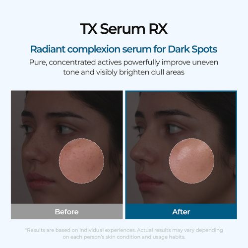 سرم ترانگزامیک اسید دکتر ملاکسین ضد لک و روشن کننده پوست Dr.Melaxin TX Ampoule Rx
