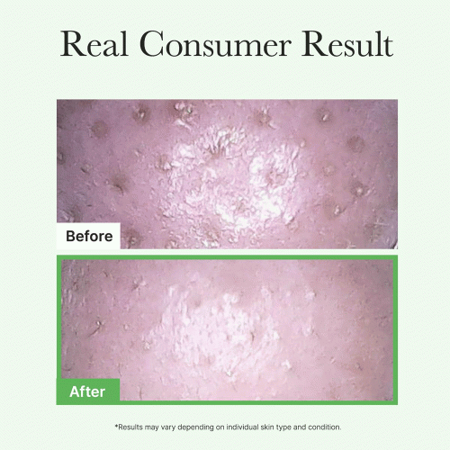 شوینده روغنی موچی کنترل منافذ آرنسیا Arencia Pore Melt Mochi Cleansing Oil