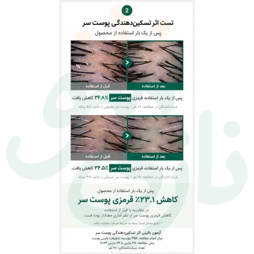 اسنس-تقویت-کننده-مو-و-کف-سر-ریپ-Raip-Revitalizing-Hair-Scalp-Essence