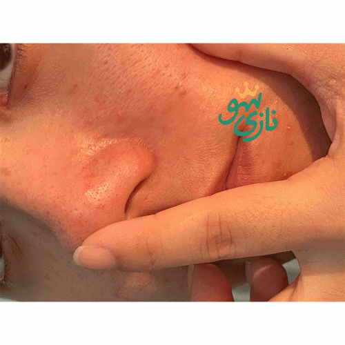 شوینده روغنی کنترل منافذ دکتر التیا Dr. Althea Gentle Pore Cleansing Oil