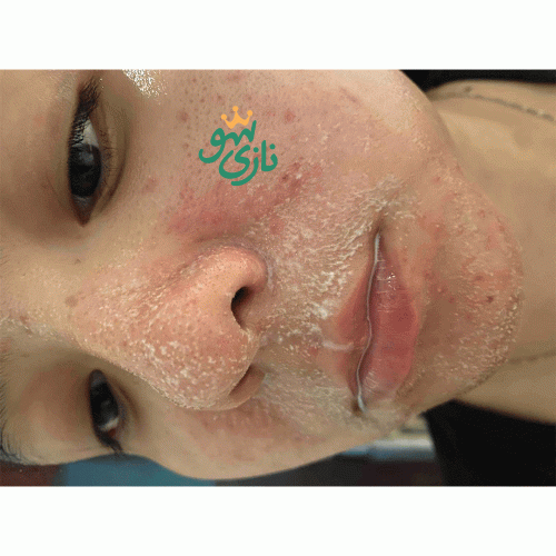 شوینده روغنی کنترل منافذ دکتر التیا Dr. Althea Gentle Pore Cleansing Oil