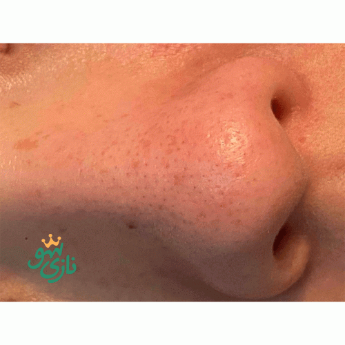 شوینده روغنی کنترل منافذ دکتر التیا Dr. Althea Gentle Pore Cleansing Oil