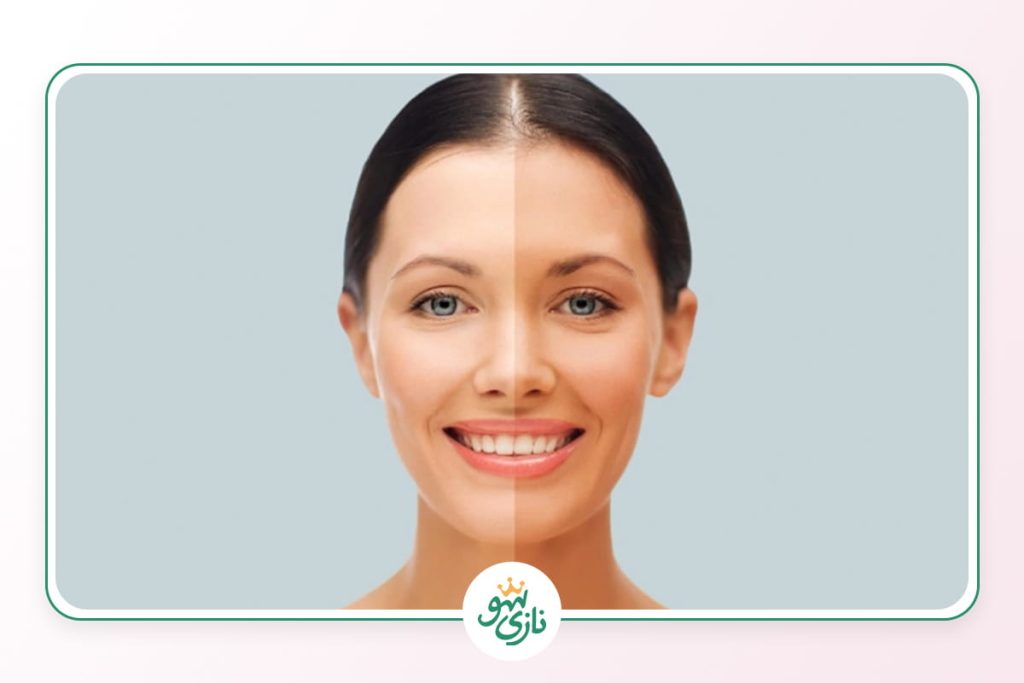 بهترین کرم روشن کننده پوست صورت چیست؟