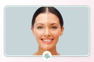 بهترین کرم روشن کننده پوست صورت چیست؟