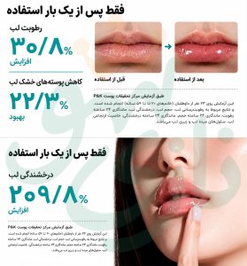 سرم-لب-PDRN-آنوا-ترمیم-کننده-و-آبرسانی-طولانی-مدت-لب-های-خشک-و-ترک-خورده-Anua-PDRN-Lip-Serum-10