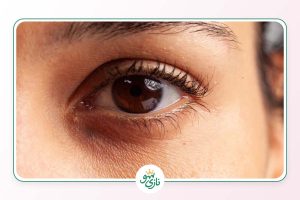 بهترین کرم و سرم دور چشم برای رفع تیرگی
