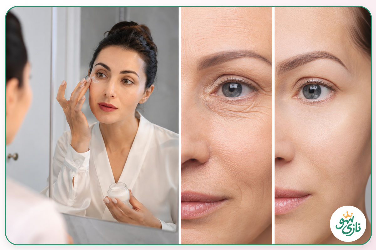 برای رفع چروک دور چشم کرم بهتر است یا سرم؟