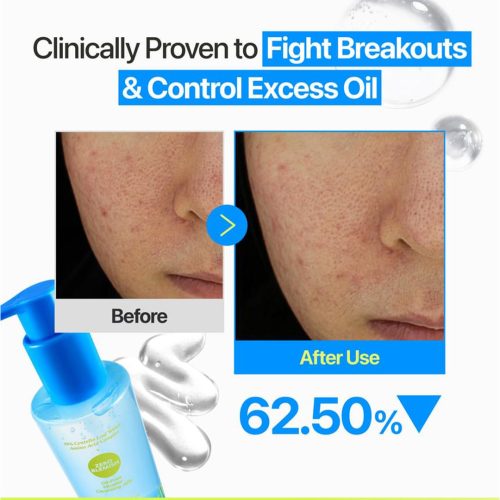 میسلار ژلی ضد جوش اویل فری نامبوزین numbuzin Zero Blemish Oil Free Micellar Cleansing Jelly