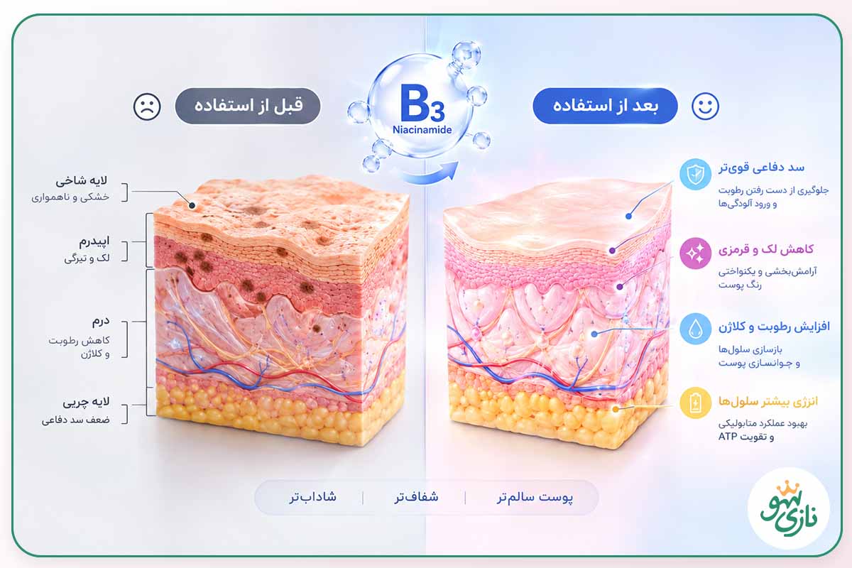 نحوه عملکرد نیاسینامید در یکدست کردن رنگ پوست