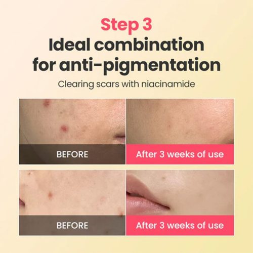 کرم ترمیم کننده، تسکین دهنده و ضد لک رد بلمیش دکتر جی Dr.G R.E.D Blemish Repair Soothing Cream
